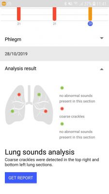 LungPass App - <Analyse der Lungentöne