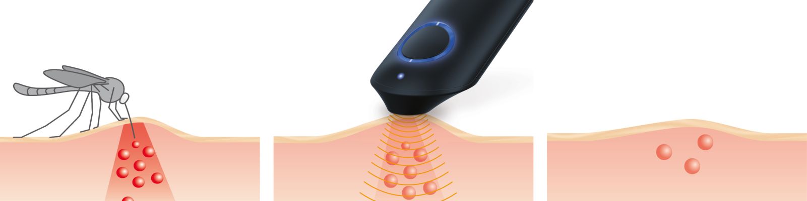 Insektenstichheiler Wirkung