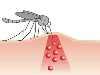 Picadura de mosquito