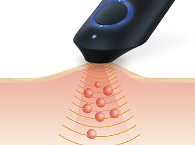 Cicatrizantes contra el picor y la hinchazón