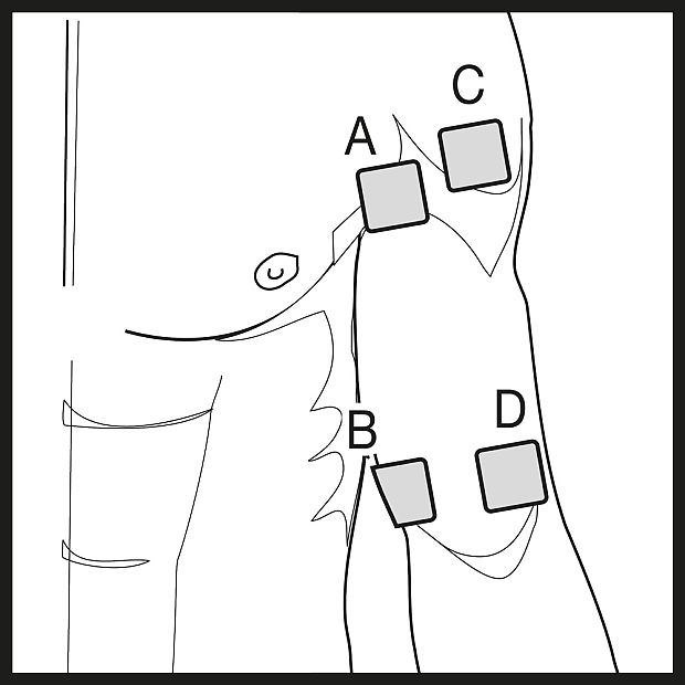 Colocación de electrodos Unidad TENS beurer