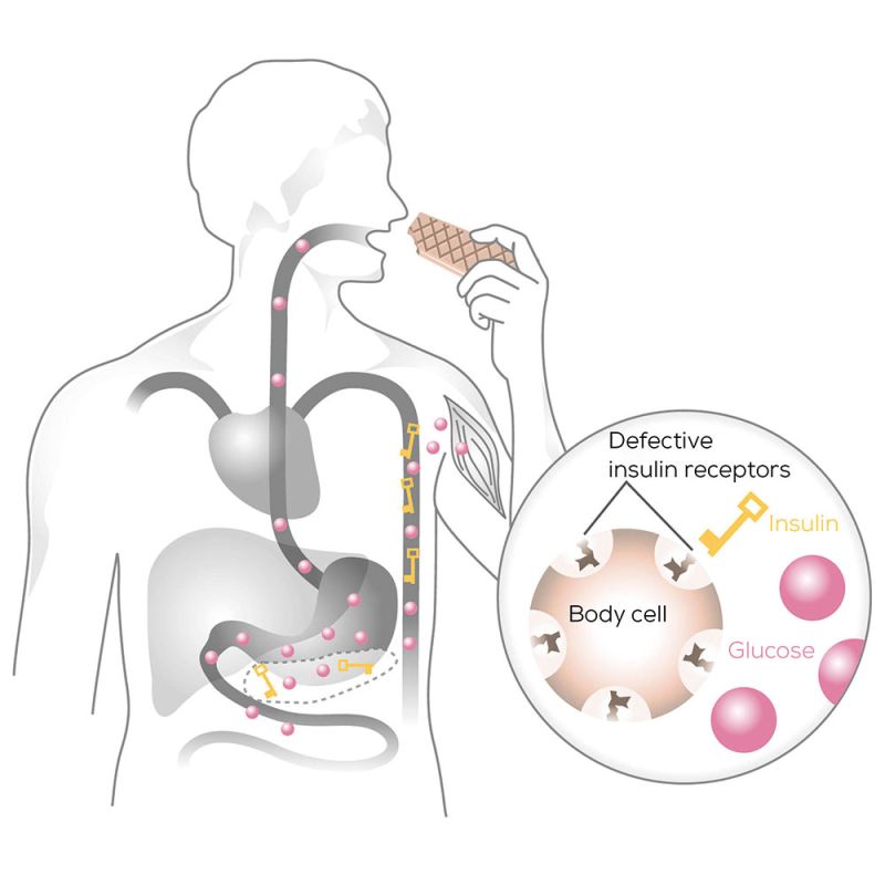 Beurer illustration blood glucose key lock principle type 2 diabetes