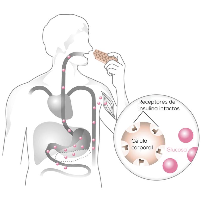 Ilustración de Beurer sobre el principio de la llave de la glucosa en sangre en la diabetes de tipo 1