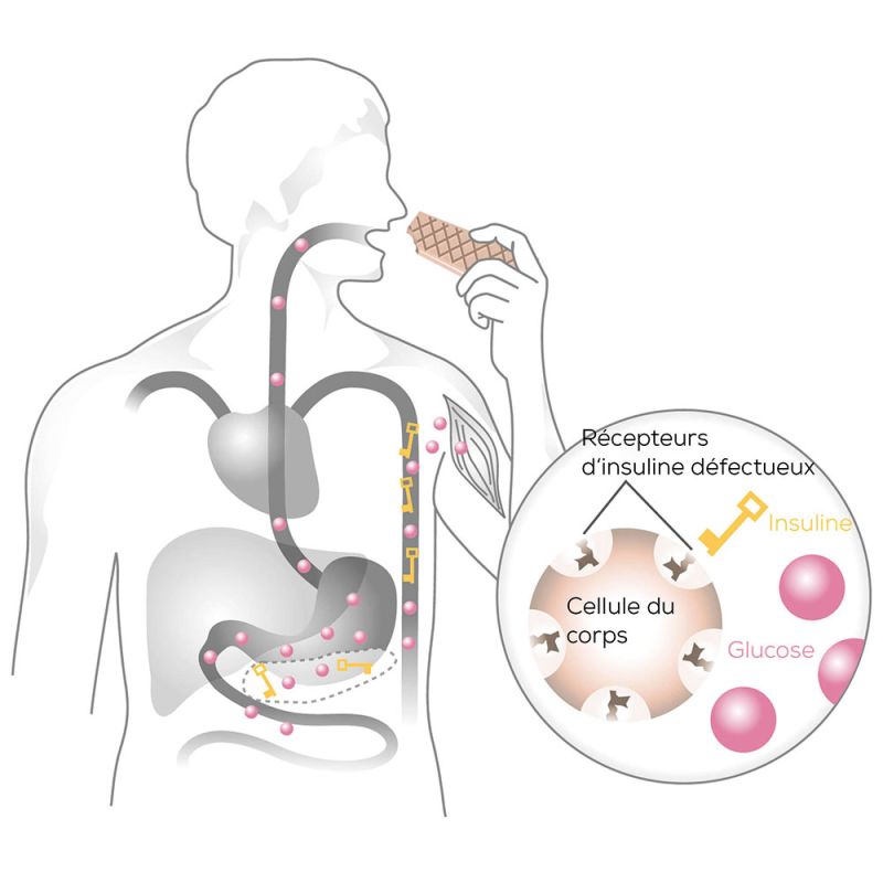 Beurer illustration clé de glycémie serrure principe diabète de type 2