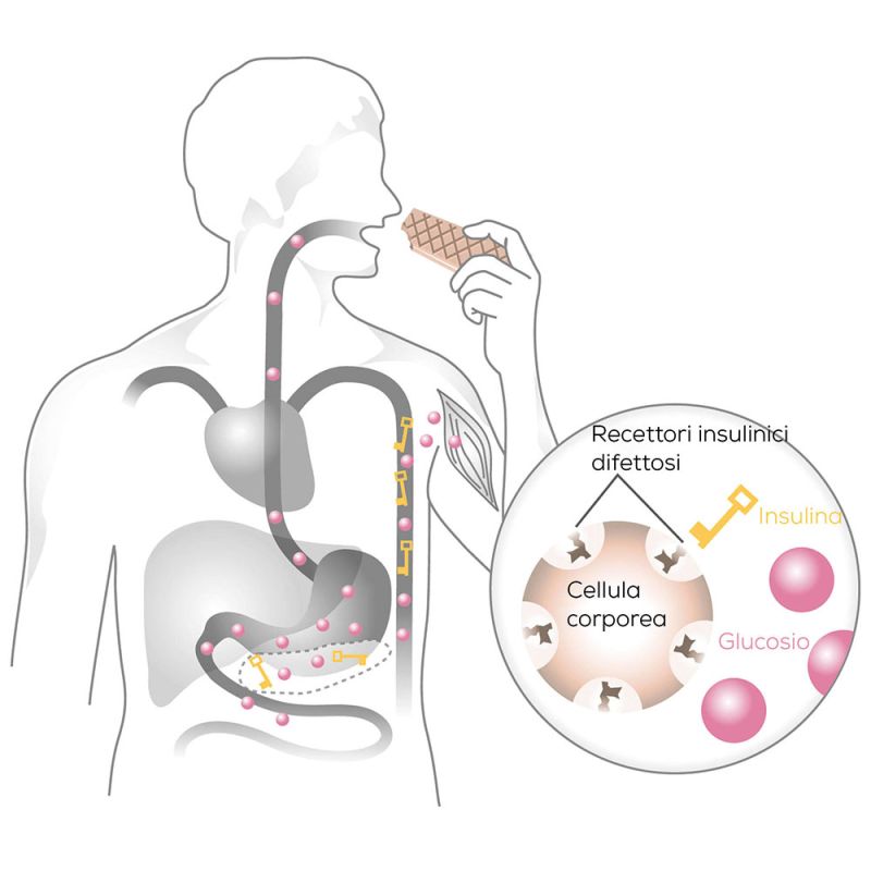 Illustrazione di Beurer del principio di chiusura della chiave della glicemia nel diabete di tipo 2
