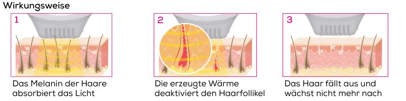 Wirkungsweise eines IPL-Geräts in drei Schritten: Melanin im Haar absorbiert das Licht. Erzeugte Wärme deaktiviert Haarfollikel. Haar fällt aus und wächst nicht mehr nach