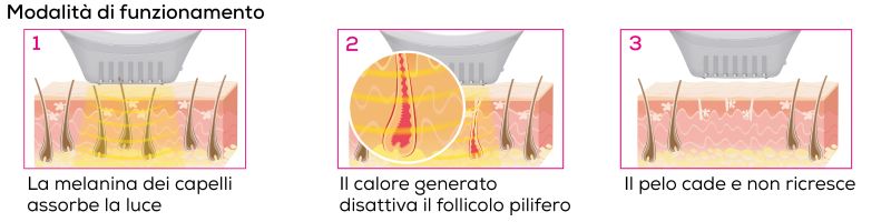 Funzionamento di un epilatore IPL in tre fasi: La melanina nel capello assorbe la luce. Il calore generato disattiva il follicolo pilifero. Il capello cade e non ricresce