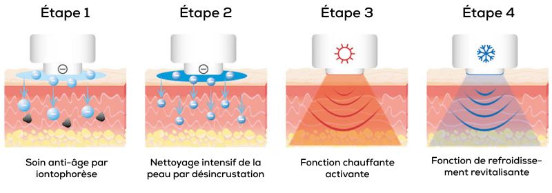 Application en 4 étapes de l'appareil Anti-Âge Beurer : Soin anti-âge par iontophorèse, nettoyage en profondeur, fonction chaleur et froid