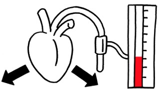 Beurer Schaubild von einem Diastole - Gefäßwert
