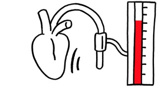 Beurer Schaubild von einem Systole - Herzwert